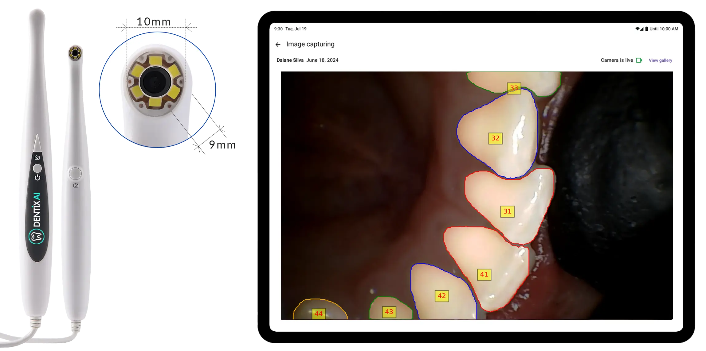 Dentix AI Camera